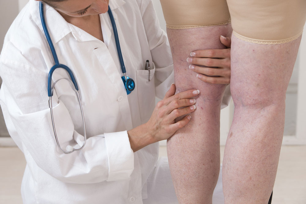 Cosmetic Surgeon near me for Varicose Vein