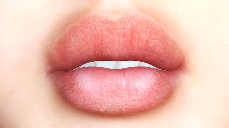 A Fuller Smile through Lip Augmentation in Los Angeles