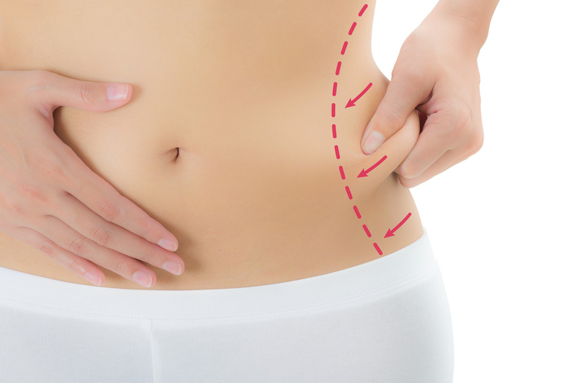 Overcome Stubborn Fat with HD Liposuction in Los Angeles