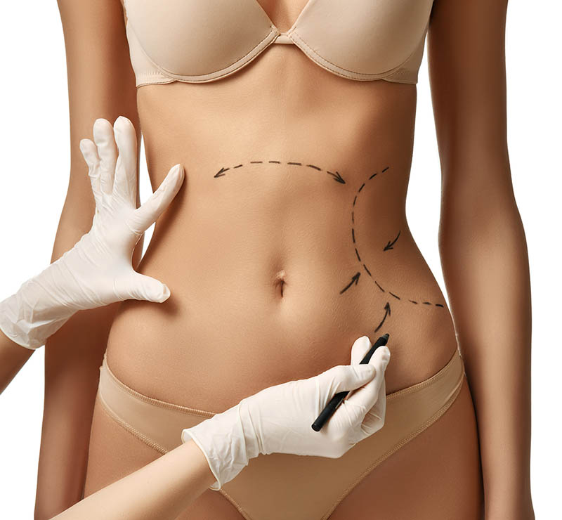 Lipo HD in Los Angeles