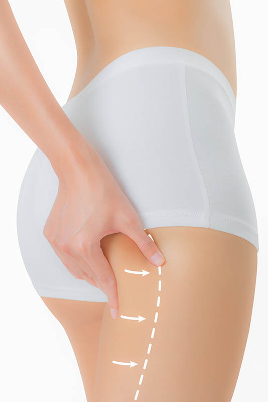 modern liposuction in Los Angeles