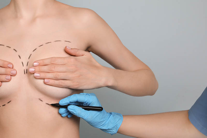 quality breast augmentation in Los Angeles