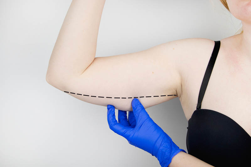 Doctor Performing Vaser Liposuction in Los Angeles