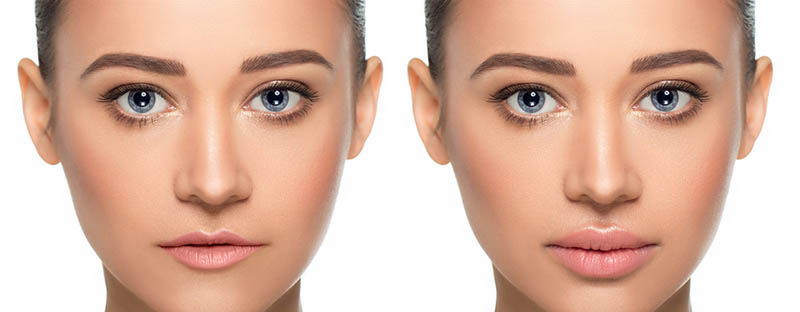 More About Botox In Beverly Hills, Los Angeles - Skin Care & Laser thumbnail