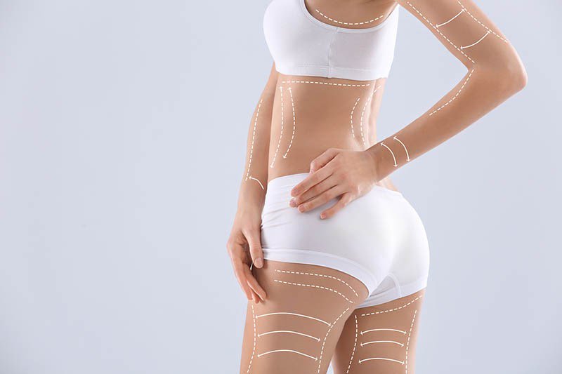 best liposuction in los angeles