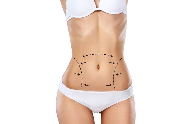 lipo high def in Los Angeles