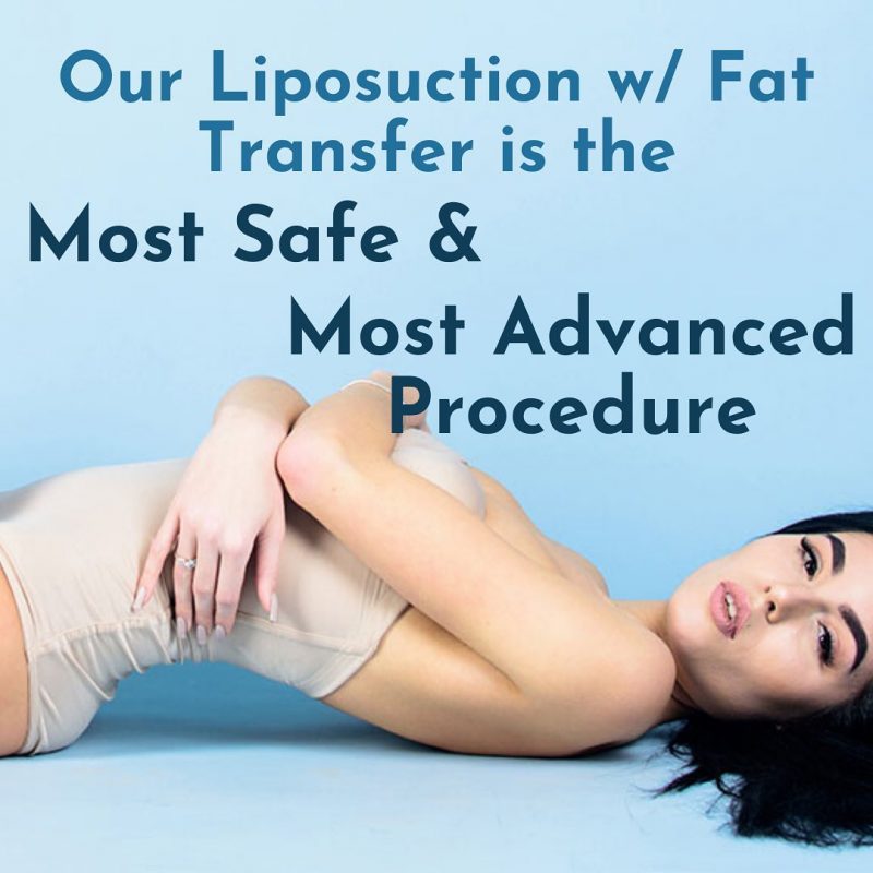liposuction high definition in Los Angeles