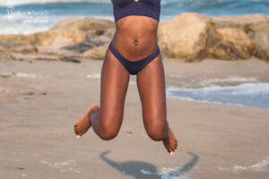 liposuction in Los Angeles,