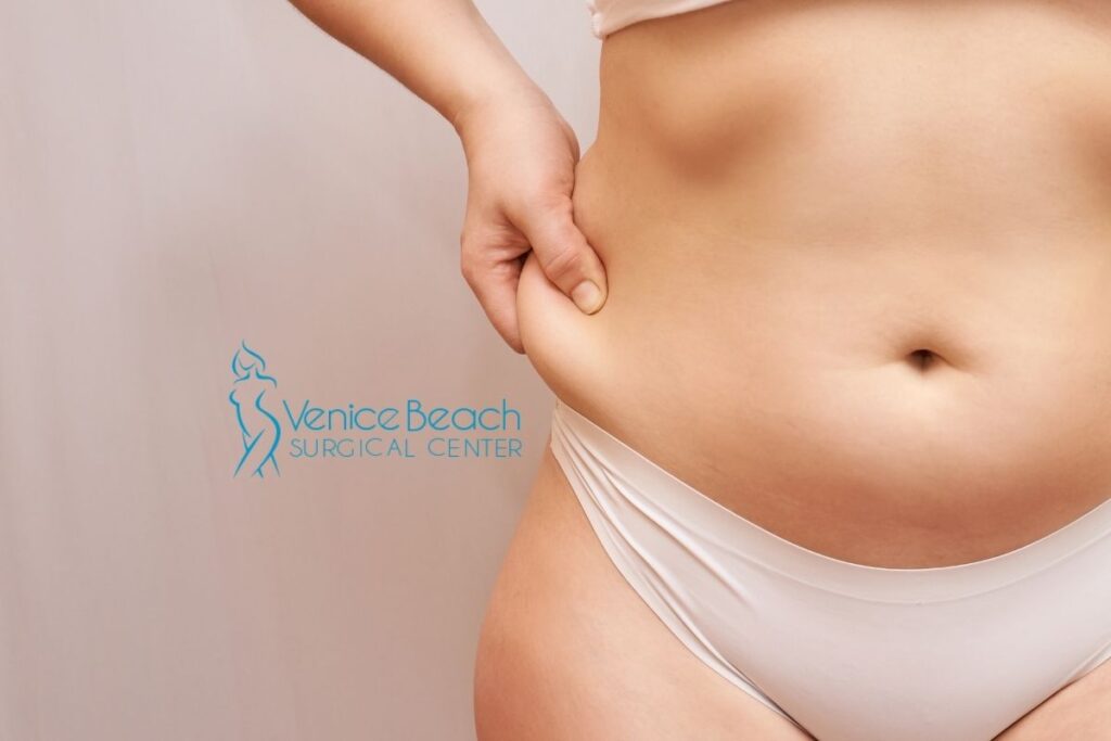 Liposuction in Los Angeles