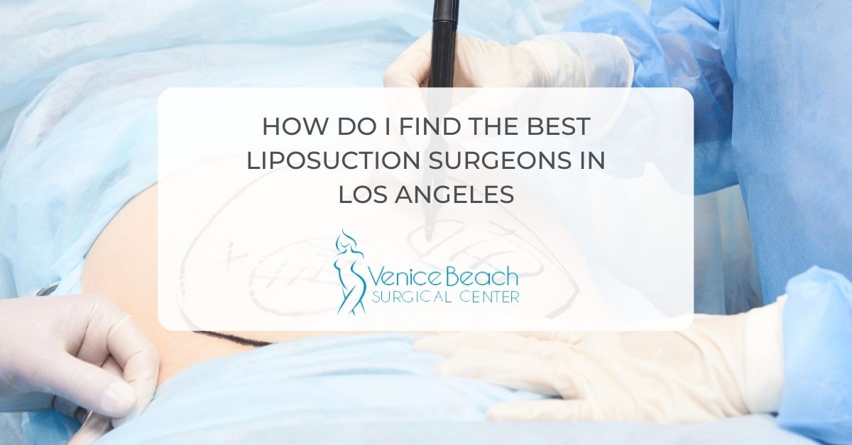 Best Liposuction Surgeons In Los Angeles