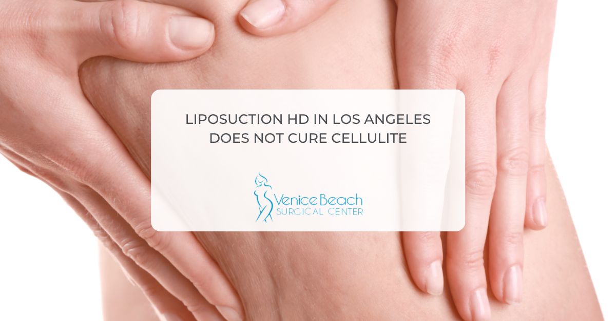 Liposuction HD in Los Angeles