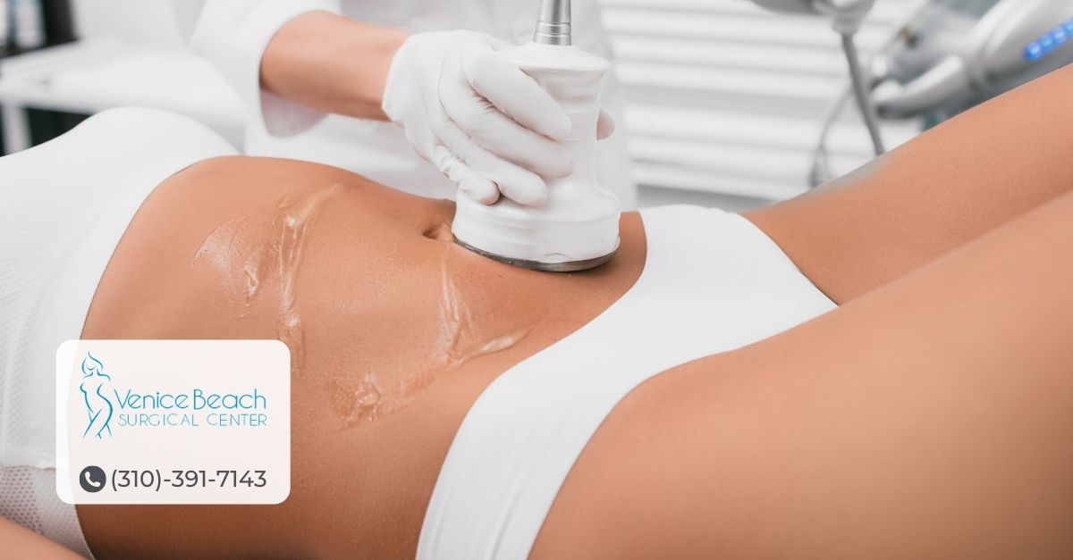 Liposuction Vaser in Los Angeles