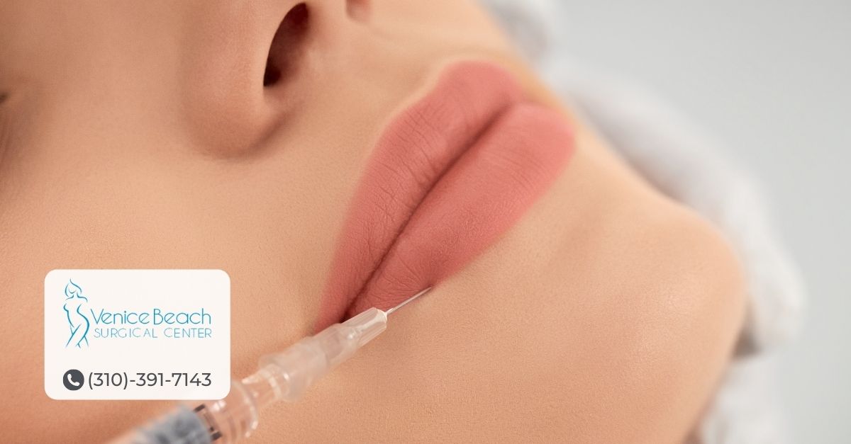 Lip Augmentation in Los Angeles