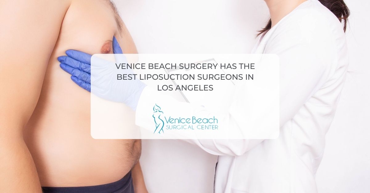 Best Liposuction Surgeons in Los Angeles