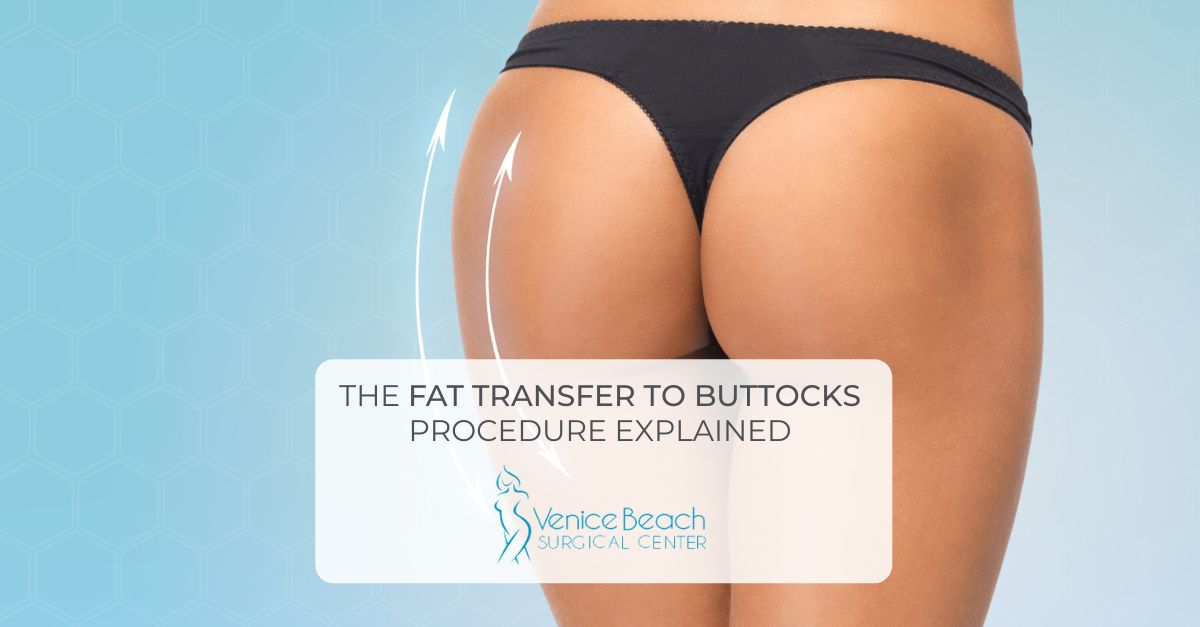 Fat Transfer to Buttocks