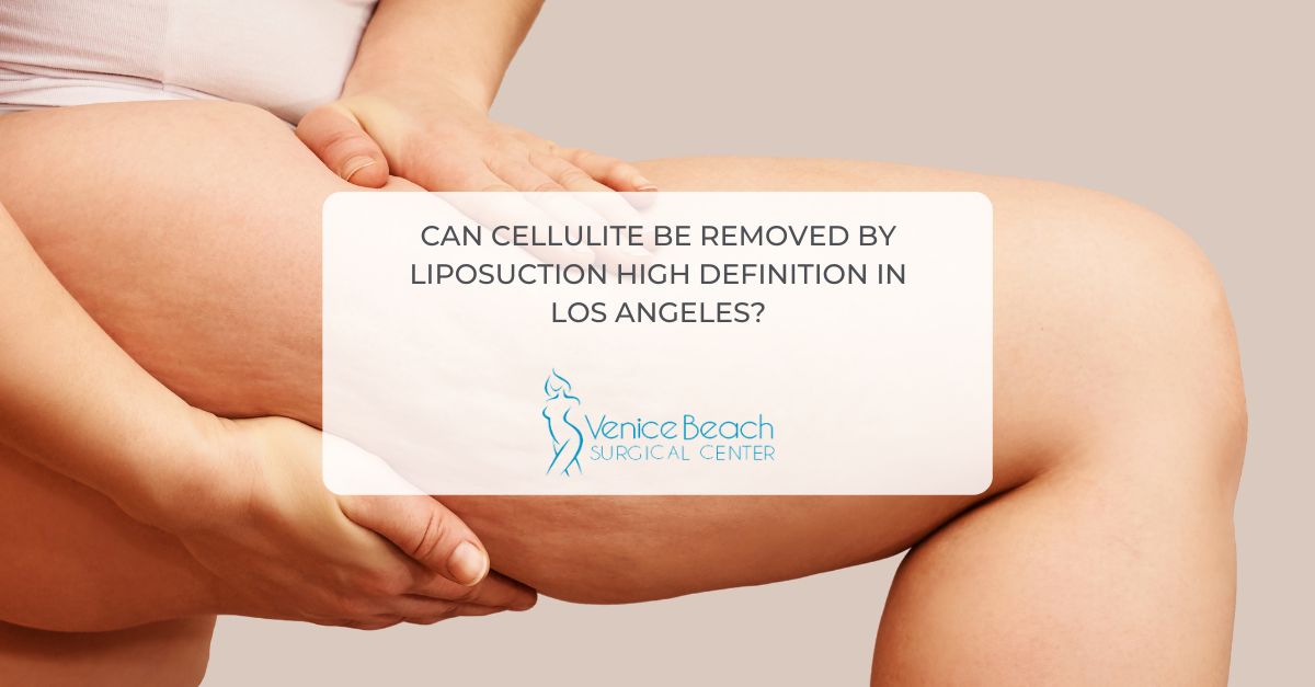 Liposuction High Definition In Los Angeles