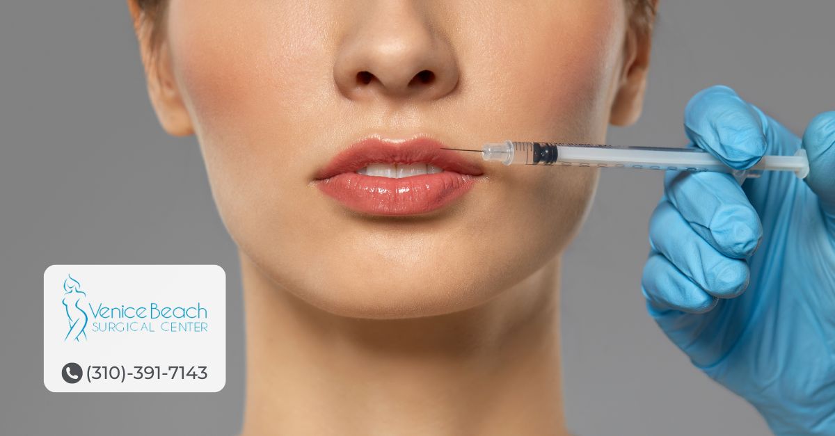 Lip Augmentation in Los Angeles