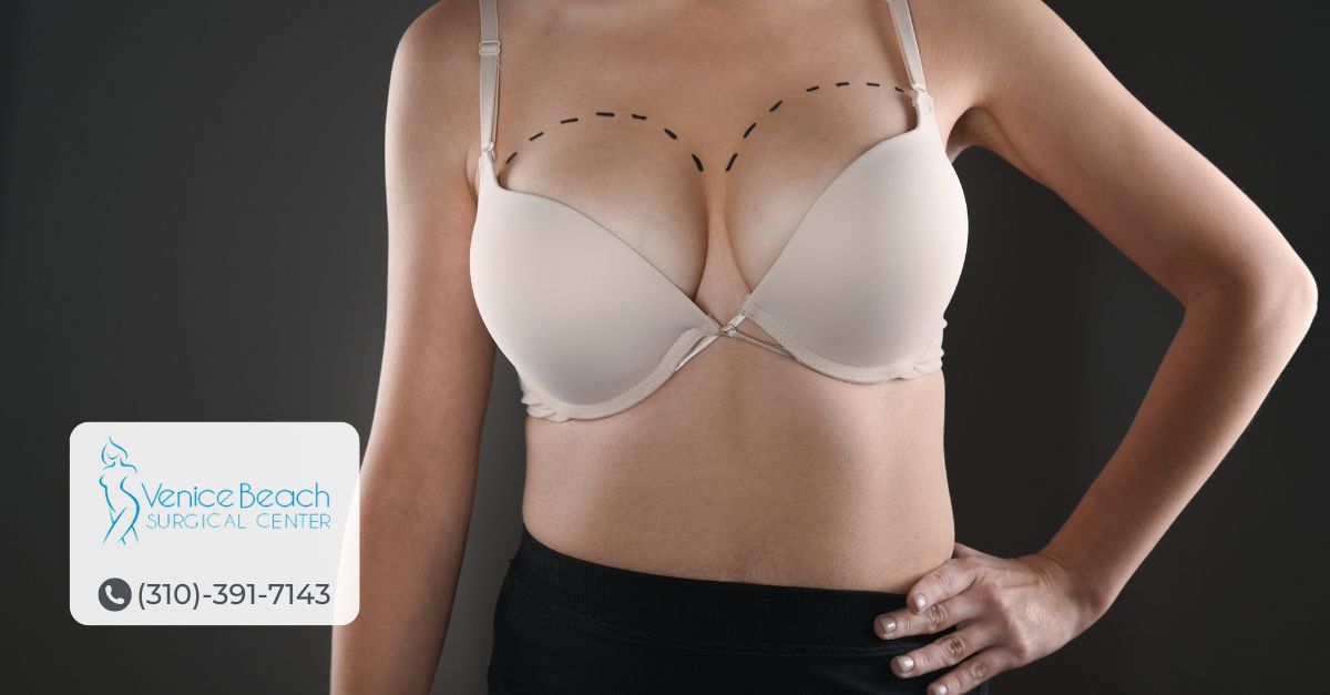 Breast Augmentation in Los Angeles