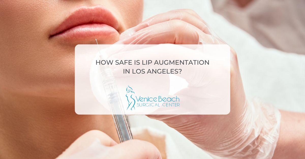 Lip Augmentation in Los Angeles